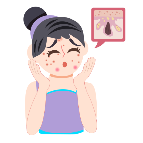 Chăm Sóc Da Mụn